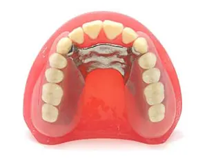 入れ歯8.8万円(税込)～「目立たない・噛める」入れ歯 – 南柏クレイン