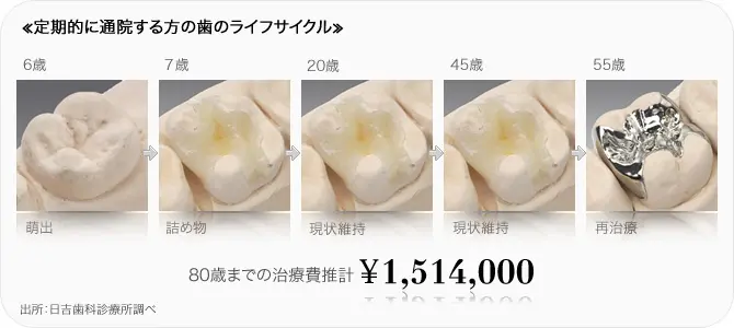 歯を守るメンテナンス「唾液検査」 – 南柏クレイン総合歯科 – 南柏駅