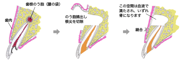 裁断済　歯根膜による再生治療 : インプラントを考える前に 歯根膜による再生治療インプラントを考える前に | 下地 勲 |本