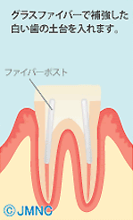 コアの作り方2