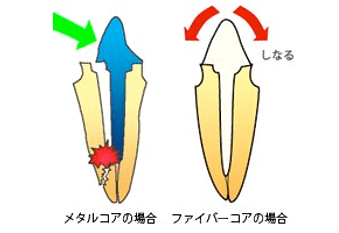 しなる性質比較