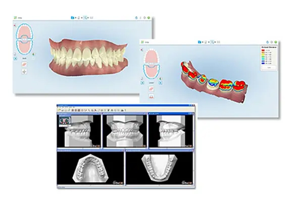 3Dシミュレーション