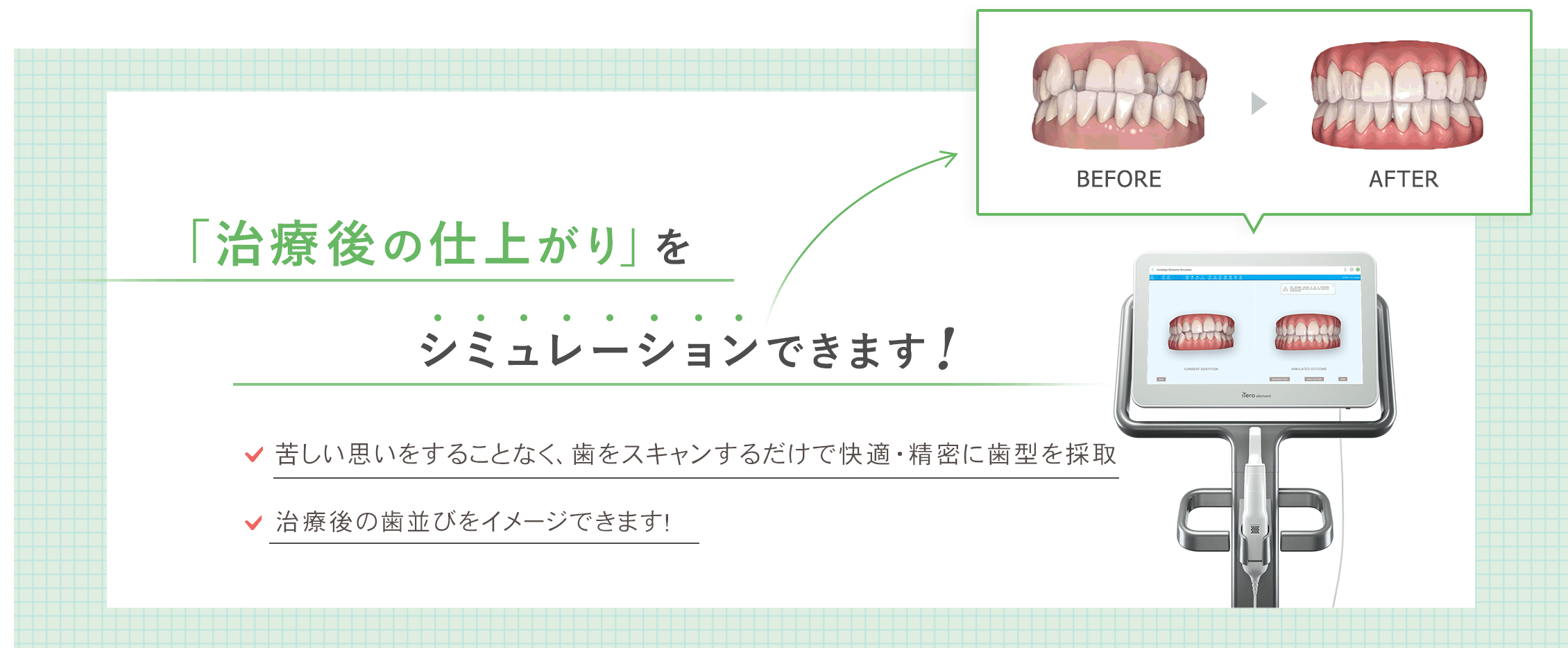 治療の仕上がりを事前にシミュレーションできます